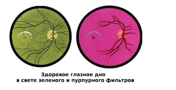 здоровое глазное дно.jpg здоровое глазное дно.jpg